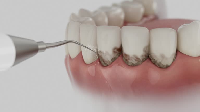Reliable Dental contractor in Kellogg, ID by Dentist Open Now